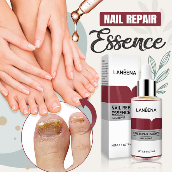 Nail Repair Essence - Image 2