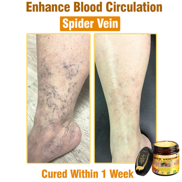 LOVILDS™ Bee Venom All-in-One Cream - Image 6