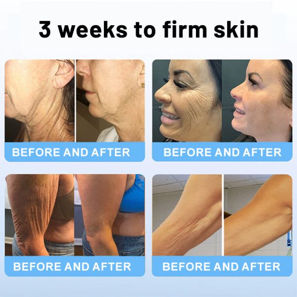 💎LOVILDS™ Botulinum Toxin Firming Serum Stick(🔥LAST DAY 70% OFF)🧡 - Image 4