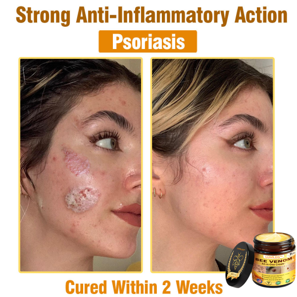 LOVILDS™ Bee Venom All-in-One Cream - Image 10