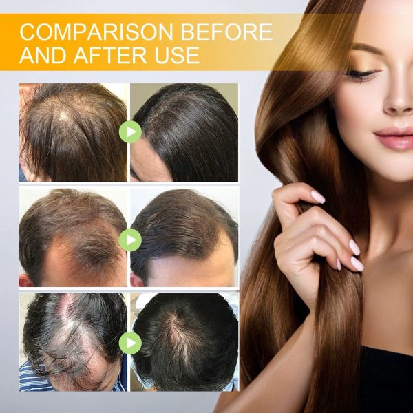 （🔥LAST DAY SALE-50% OFF) Lovilds™ Biotin Premium Hair Growth Serum - Image 2