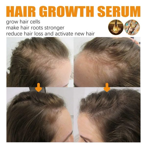 （🔥LAST DAY SALE-50% OFF) Lovilds™ Biotin Premium Hair Growth Serum - Image 4