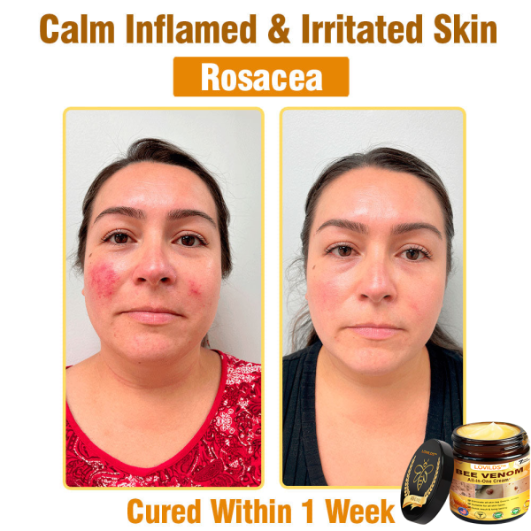 LOVILDS™ Bee Venom All-in-One Cream - Image 11