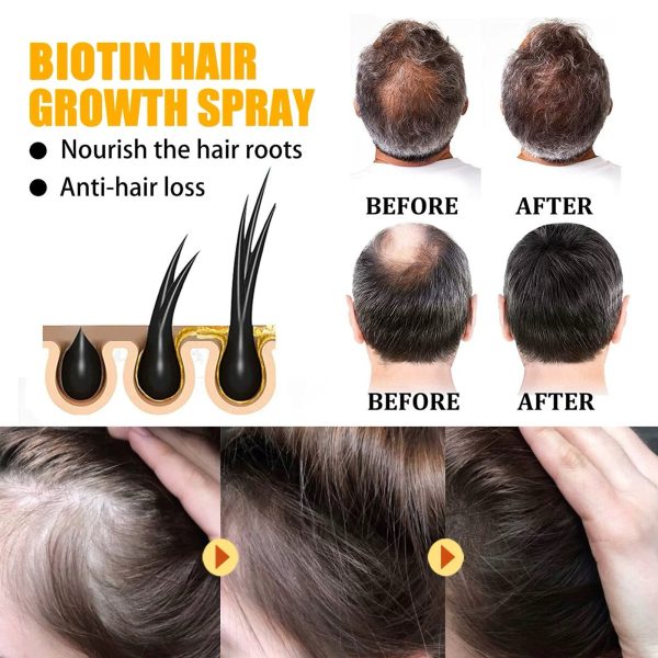 （🔥LAST DAY SALE-50% OFF) Lovilds™ Biotin Premium Hair Growth Serum - Image 3
