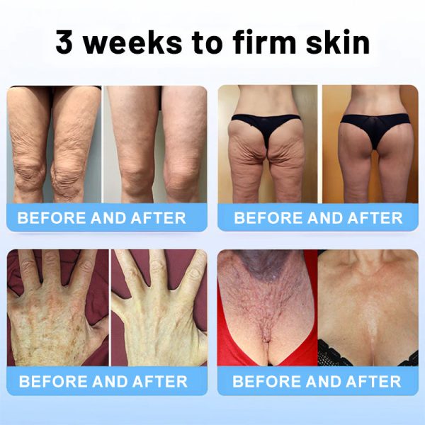 💎LOVILDS™ Botulinum Toxin Firming Serum Stick(🔥LAST DAY 70% OFF)🧡 - Image 3